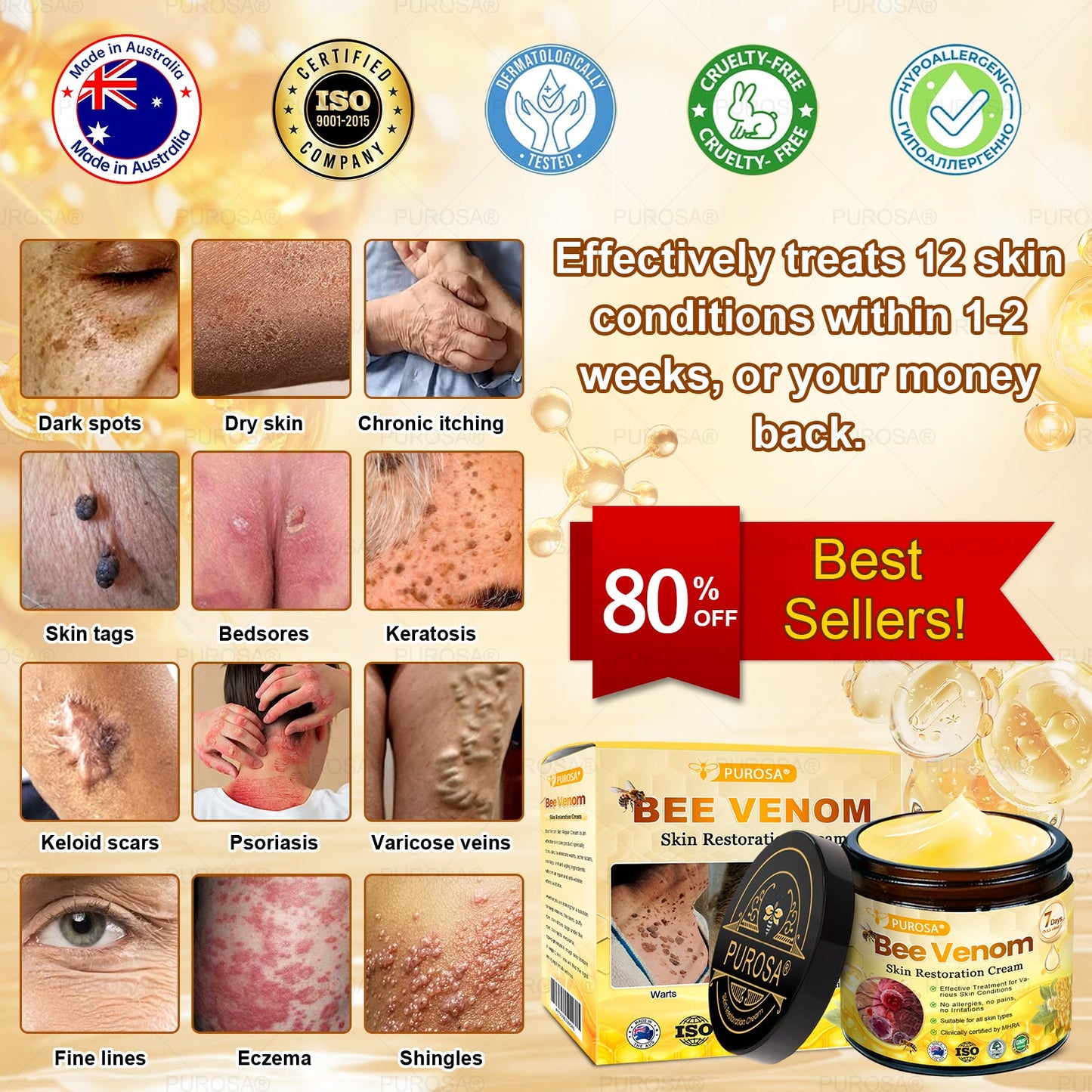 ✅PUROSA® Bee Venom Skin Treatment Cream, Anti-aging, Hydrating, Skin Repair, Even Tone, Acne and Dark Spot Treatment, Wart and Mole Removal, Psoriasis Relief