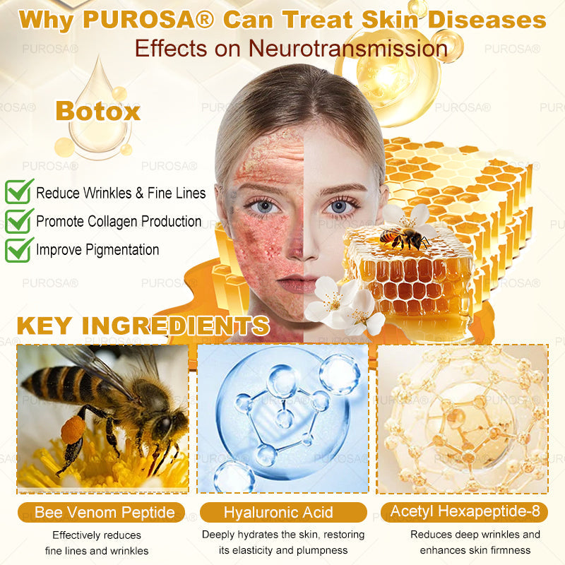 ✅PUROSA® Bee Venom Skin Treatment Cream, Anti-aging, Hydrating, Skin Repair, Even Tone, Acne and Dark Spot Treatment, Wart and Mole Removal, Psoriasis Relief